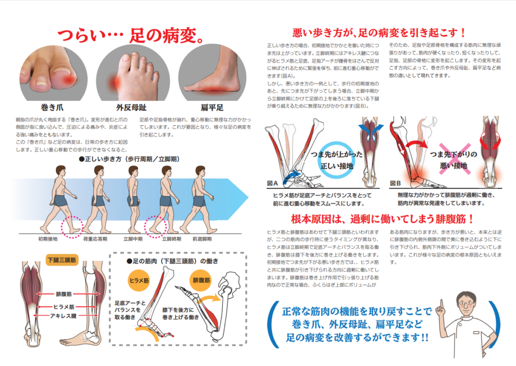 正常な筋肉の機能を取り戻すことで足の病変を改善するができます